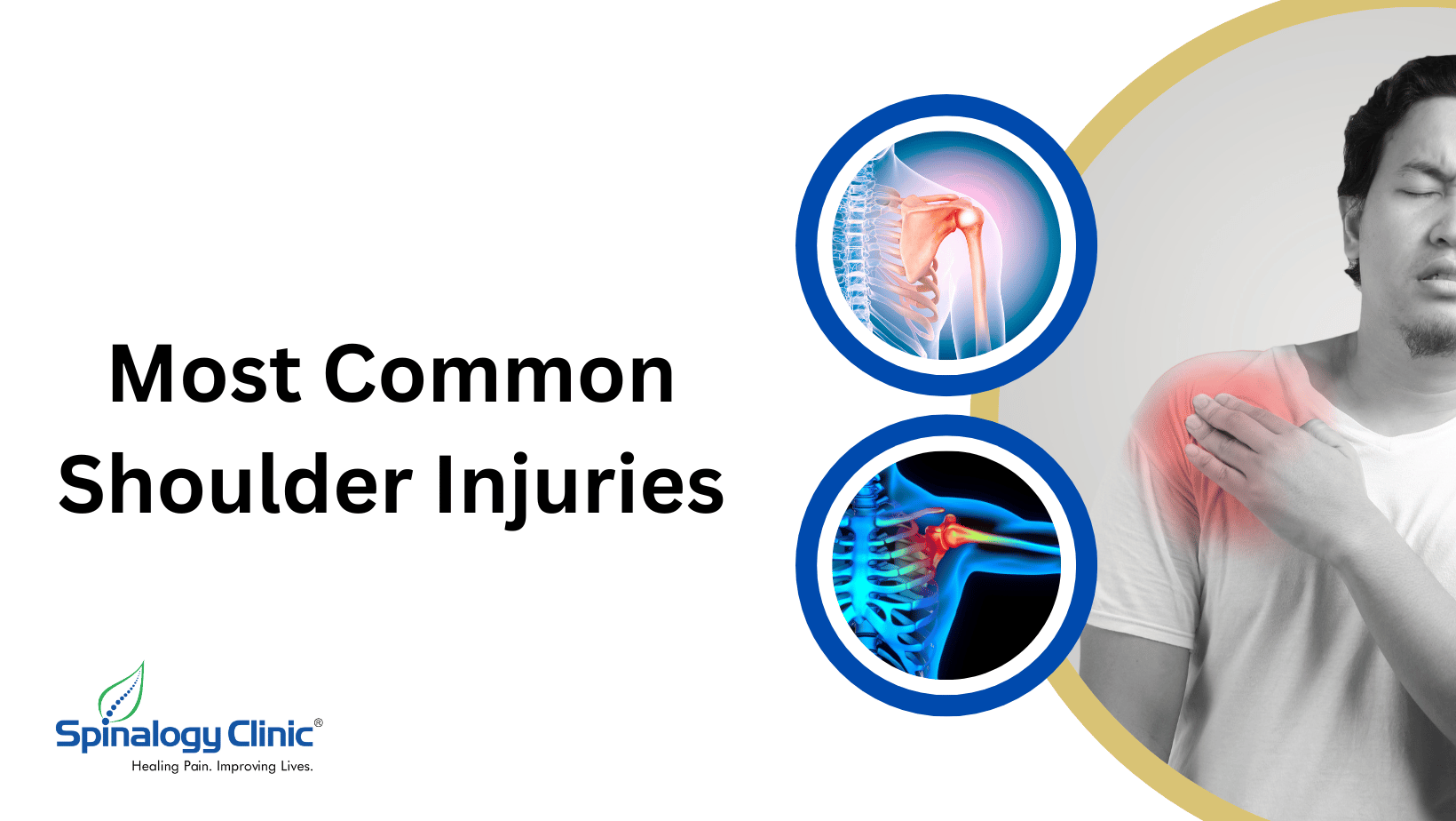 Most Common Shoulder Injuries